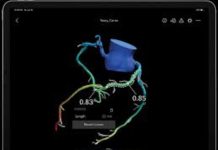 Heartflow Targets $180M IPO to Expand 3D Heart Imaging Software Heartflow IPO