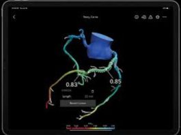 Heartflow Targets $180M IPO to Expand 3D Heart Imaging Software Heartflow IPO