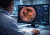 Singapore Clears AI Tool CystoSmart for Bladder Cancer